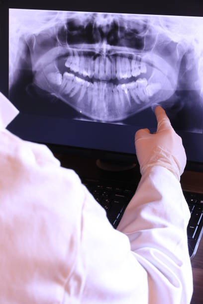 Best Dental Abscess Treatment in Ridgefield, NJ